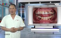 Vui khỏe 24/7: Tác hại của ma túy đá Vui khỏe 24/7: Tác hại của ma túy đá