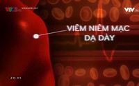 Vui khỏe 24/7: Uống thuốc giảm đau sau khi uống rượu hại như uống thuốc độc? Vui khỏe 24/7: Uống thuốc giảm đau sau khi uống rượu hại như uống thuốc độc?