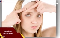 Vui khỏe 24/7: Tự nặn mụn có gây hại cho làn da và sức khỏe? Vui khỏe 24/7: Tự nặn mụn có gây hại cho làn da và sức khỏe?