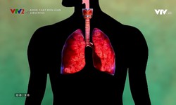 Khỏe thật đơn giản: Viêm phổi